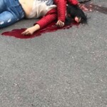 Chinese young girl lost her brain in car accident