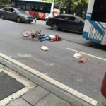Chinese young girl lost her brain in car accident