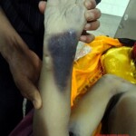 Corpse of young Chinese girl