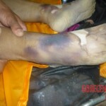 Corpse of young Chinese girl