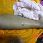 Corpse of young Chinese girl