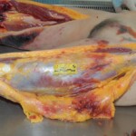 Autopsy of female jumper