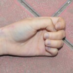 Autopsy of female jumper