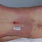 Autopsy of female jumper