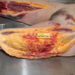 Autopsy of female jumper