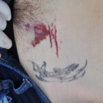 Autopsy of female jumper