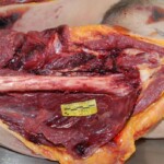 Autopsy of female jumper