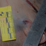 Autopsy of female jumper