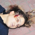 Autopsy of female jumper