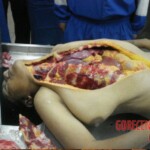 Autopsy of brazilian female