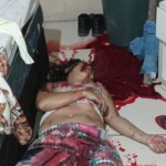 Woman shot to the head