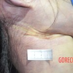 Hanged Chinese woman