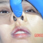 Hanged Chinese woman