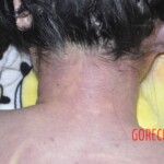 Hanged Chinese woman