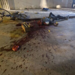 Man with smashed head