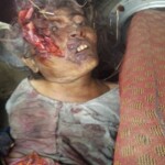 Dead woman