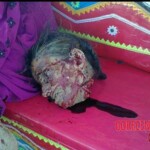 Dead woman