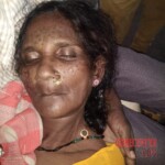 Dead woman