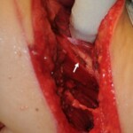 Woman murdered by katana