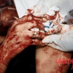 O. J. Simpson crime scene