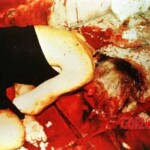 O. J. Simpson crime scene