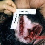 The Rettendon murders