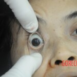 Dissection of stabbed woman