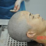 Dissection of stabbed woman