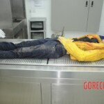 Dissection of stabbed woman