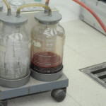 Dissection of stabbed woman