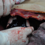 Dissection of stabbed woman