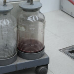 Dissection of stabbed woman