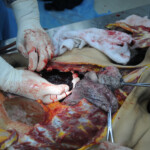 Dissection of stabbed woman