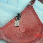 Dissection of stabbed woman