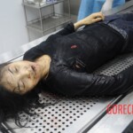 Dissection of stabbed woman