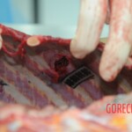 Dissection of stabbed woman