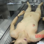Dissection of stabbed woman