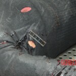 Dissection of stabbed woman