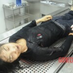 Dissection of stabbed woman