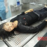 Dissection of stabbed woman