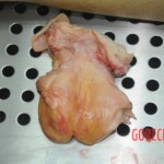 Dissection of stabbed woman