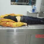 Dissection of stabbed woman