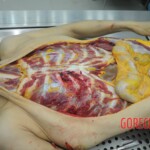 Dissection of stabbed woman