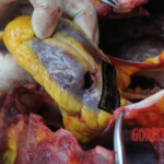 Dissection of stabbed woman