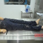 Dissection of stabbed woman