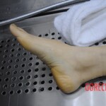 Dissection of stabbed woman