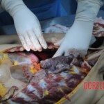 Dissection of stabbed woman