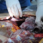 Dissection of stabbed woman