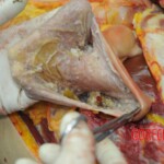 Dissection of stabbed woman