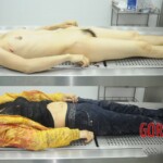 Dissection of stabbed woman